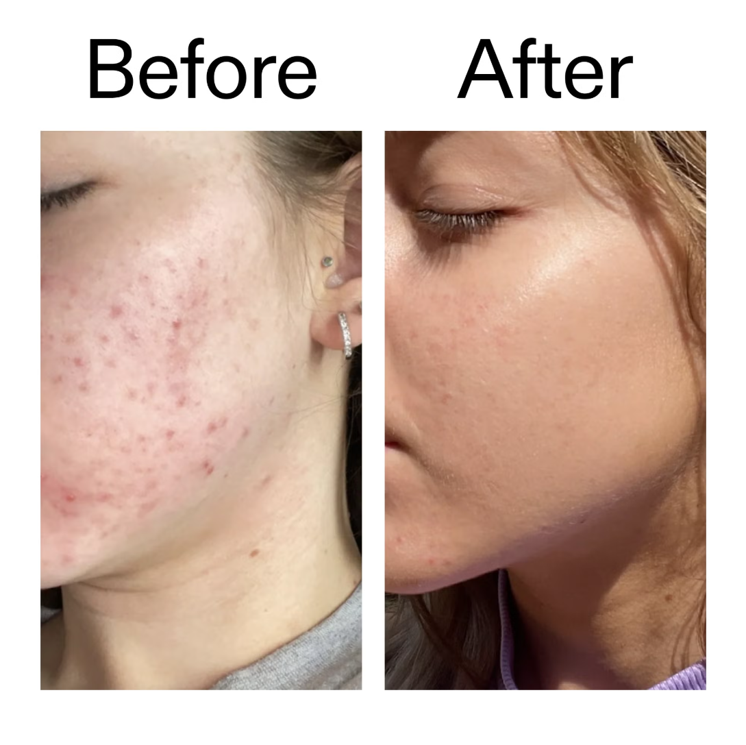The INKEY List Niacinamide Serum 30ml