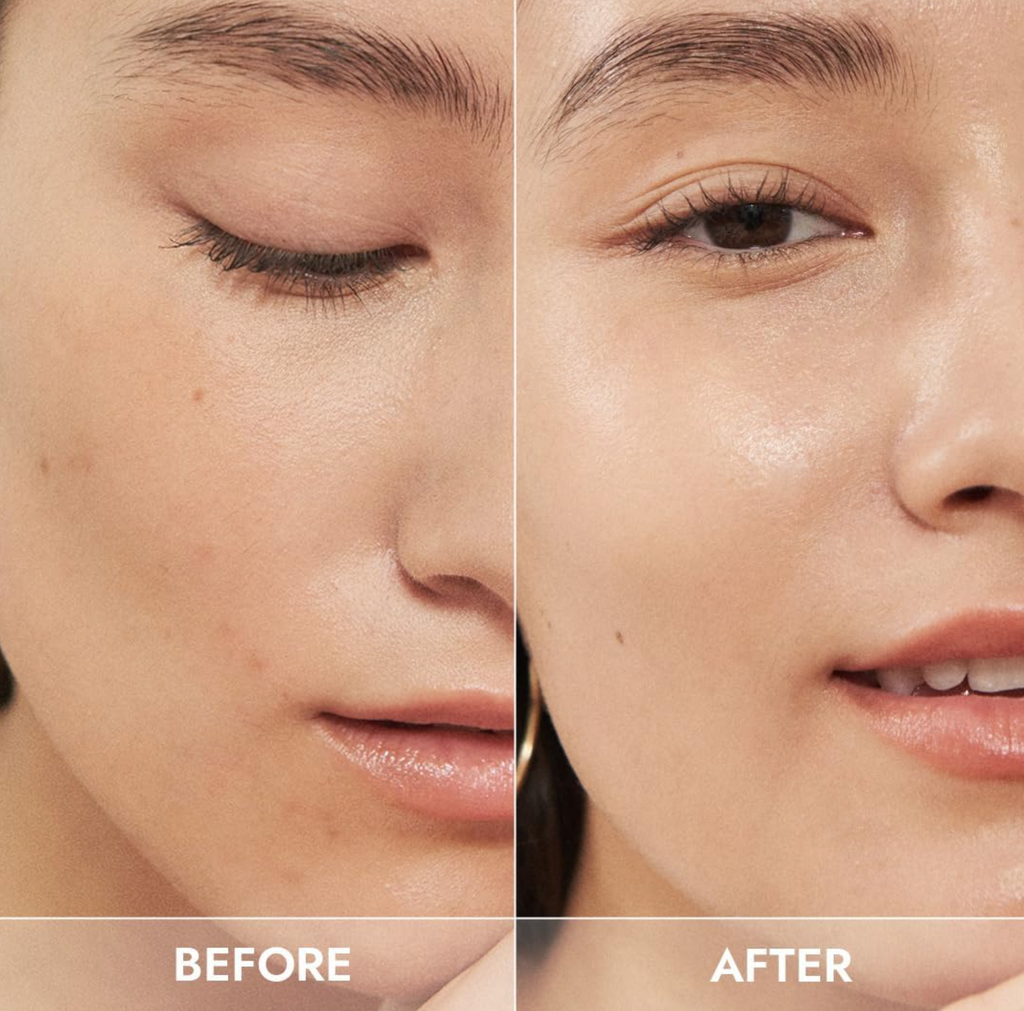 CICALURONIC SERUM (30ml) Korean Skincare - Vegan Care - Ultra Hydrating & Soothing Serum - Hyaluronic Acid & Centella Asiatica - 93% Natural Ingredients